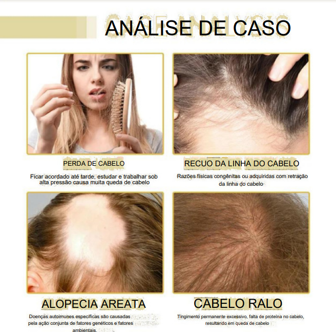 Hair Growth  A Fórmula Mágica para crescimento capilar( Promoção 60% de desconto) + frete grátis